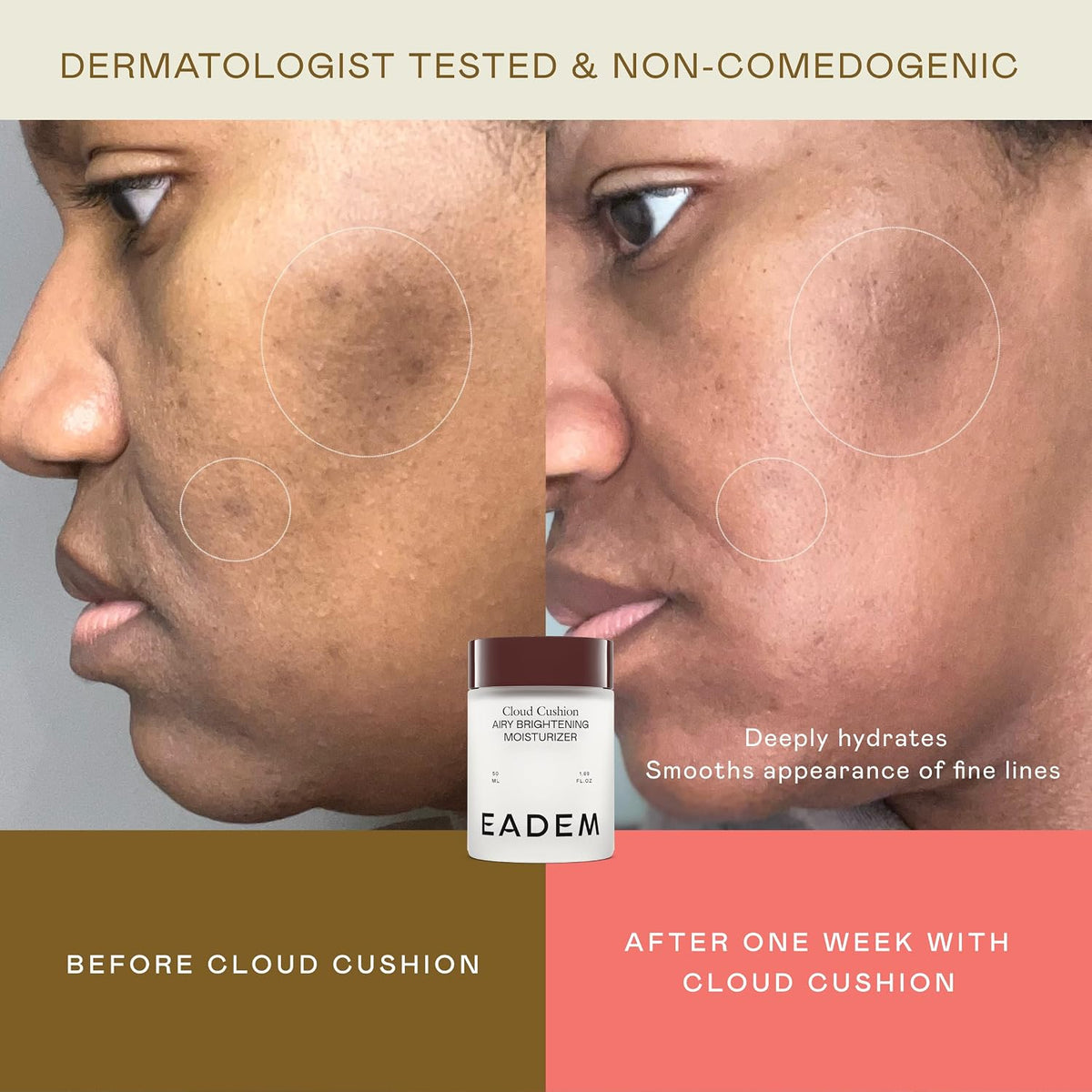 EADEM Face Moisturizer Barrier Repair Cream for Women, Cloud Cushion | Infused with Snow Mushroom, Peptides & Ceramides, Ultra Repair Formula, Deeply Hydrating Skin Care, Smoothes & Restores